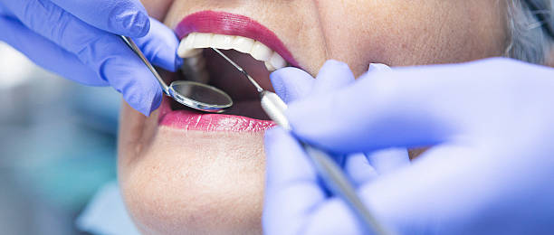 Best Emergency Dental Care for Broken or Chipped Teeth in Greenlawn, NY
